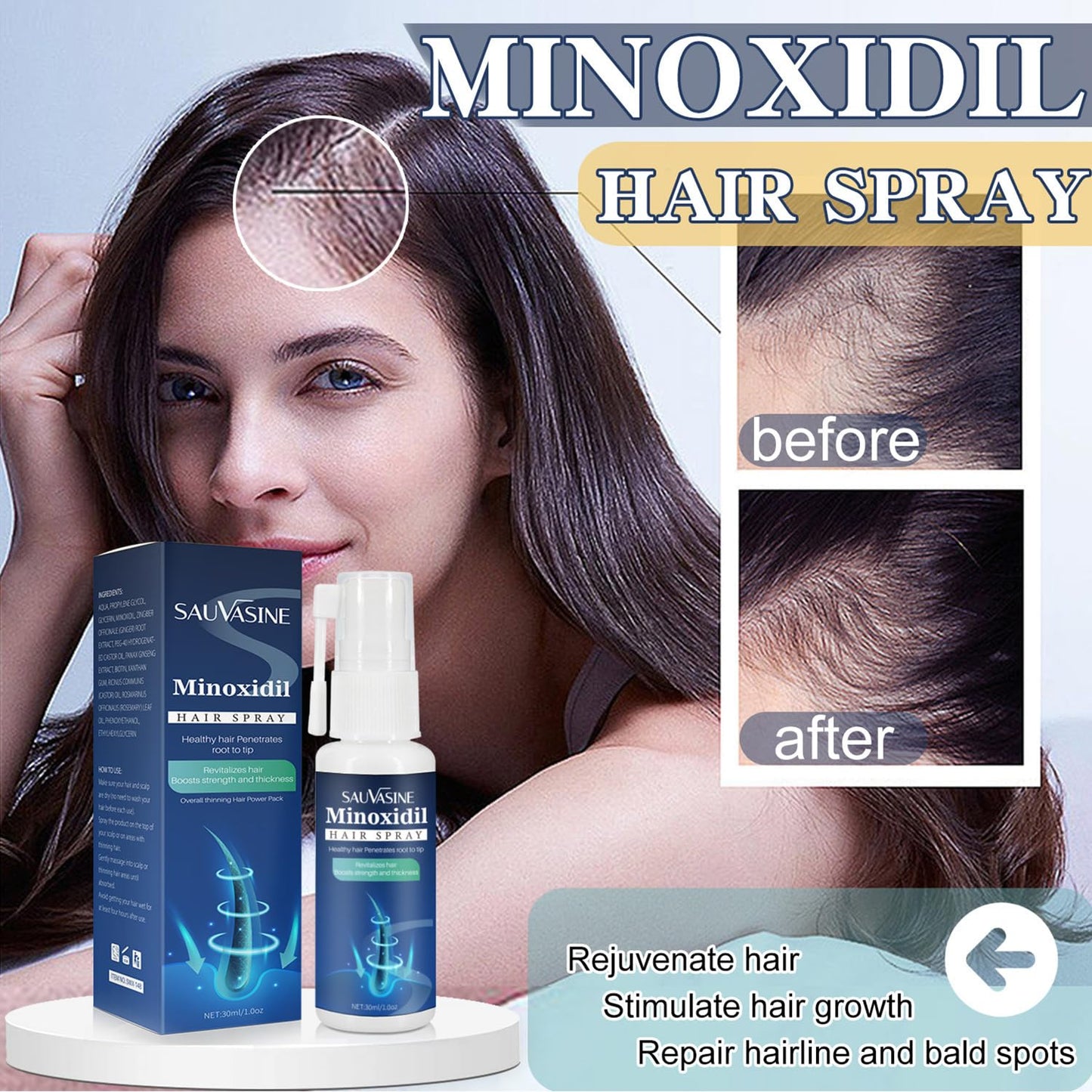 Minoxidil Hair Growth Spray Hair Growth Spray. Anti-Hair Loss, Stops Hair Thinning, Boosts Hair Strength And Thickens Hair, Treatment Spray